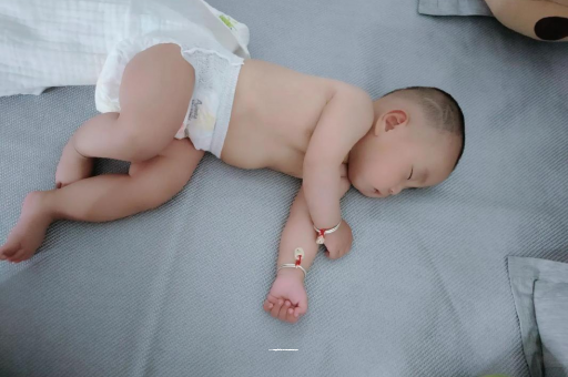 沈阳宝宝褶皱处擦粉还是油